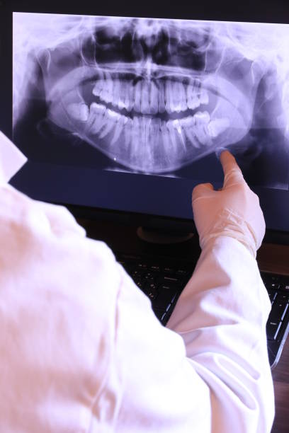 Best Emergency Tooth Extraction in California, MO